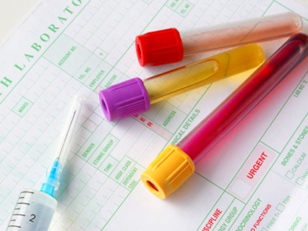 Φυσιολογικές τιμές μικροβιολογικών εργαστηριακών εξετάσεων